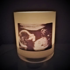 Design Your Own | Personalised | BABY SCAN | Photo | Boxed Soy Candle | New Baby | Mum To Be
